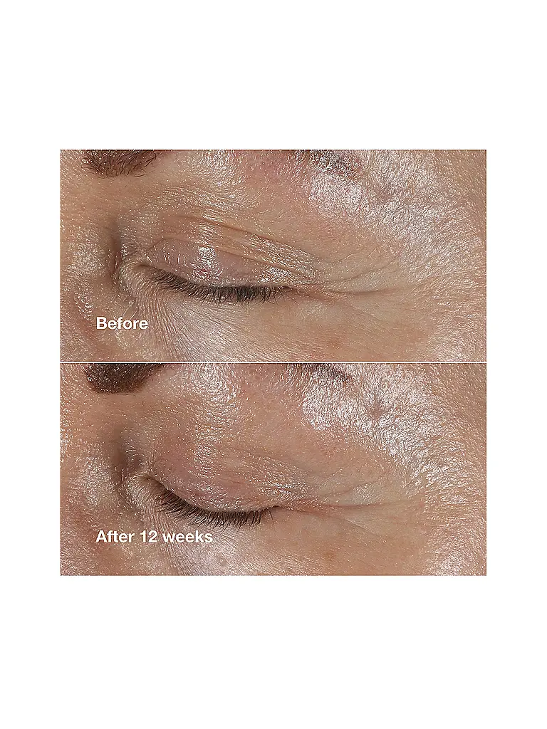 CLINIQUE | Augenpflege - Smart Clinical Repair Wrinkle Correction Eye Cream 30ml | keine Farbe