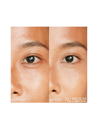 SHISEIDO | Synchro Skin Radiant Lifting Concealer 103
